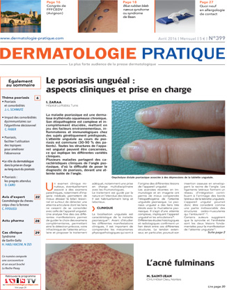 Article Psoriasis